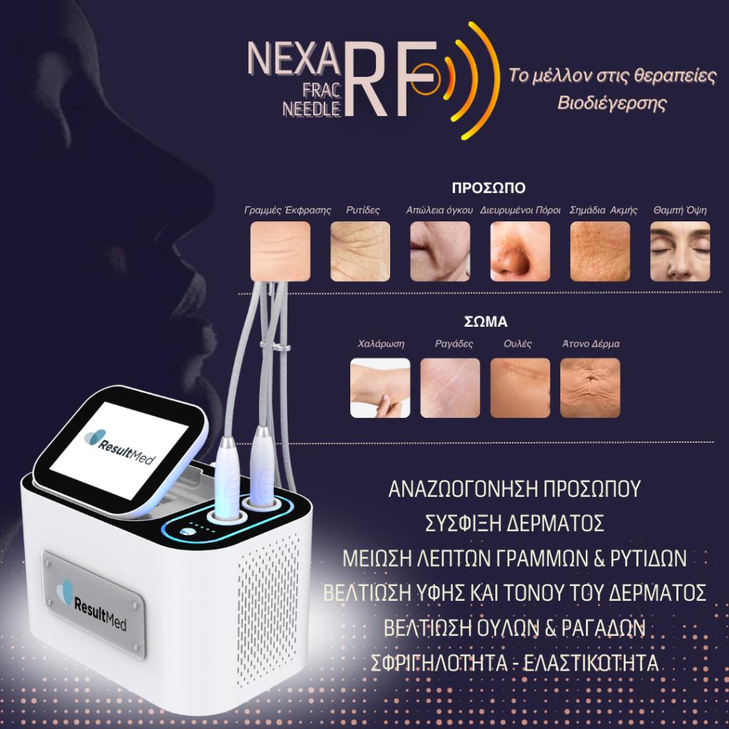 Nexa RF fractional microneedling device promotional poster in Greek