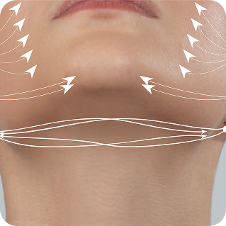 Lower face and jaw with white arrows showing lift directions